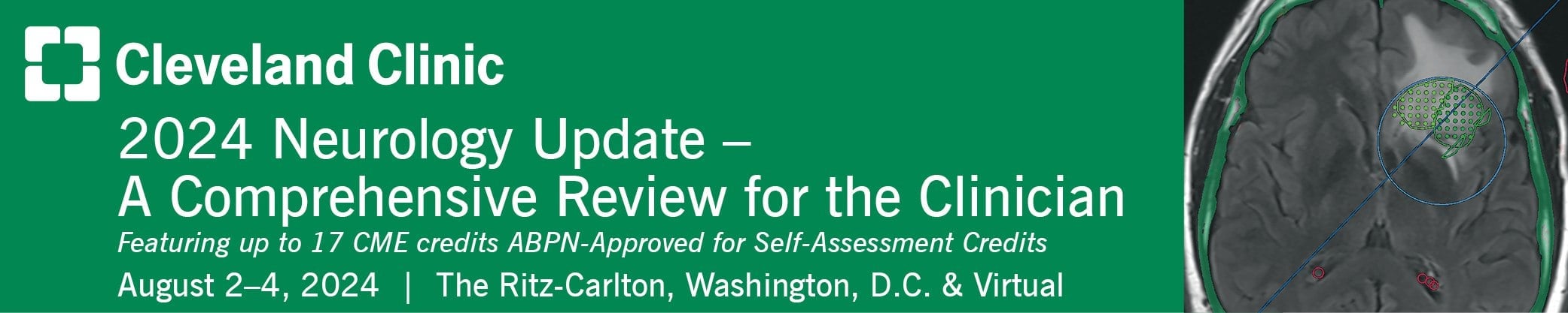 15th Annual Neurology Update 2024