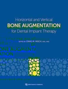 Horizontal and Vertical Bone Augmentation for Dental Implant Therapy
