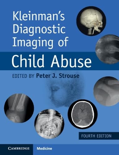 Kleinman’s Diagnostic Imaging of Child Abuse, 4th edition (Original PDF from Publisher) Kleinman’s Diagnostic Imaging of Child Abuse, 4th edition (Original PDF from Publisher)