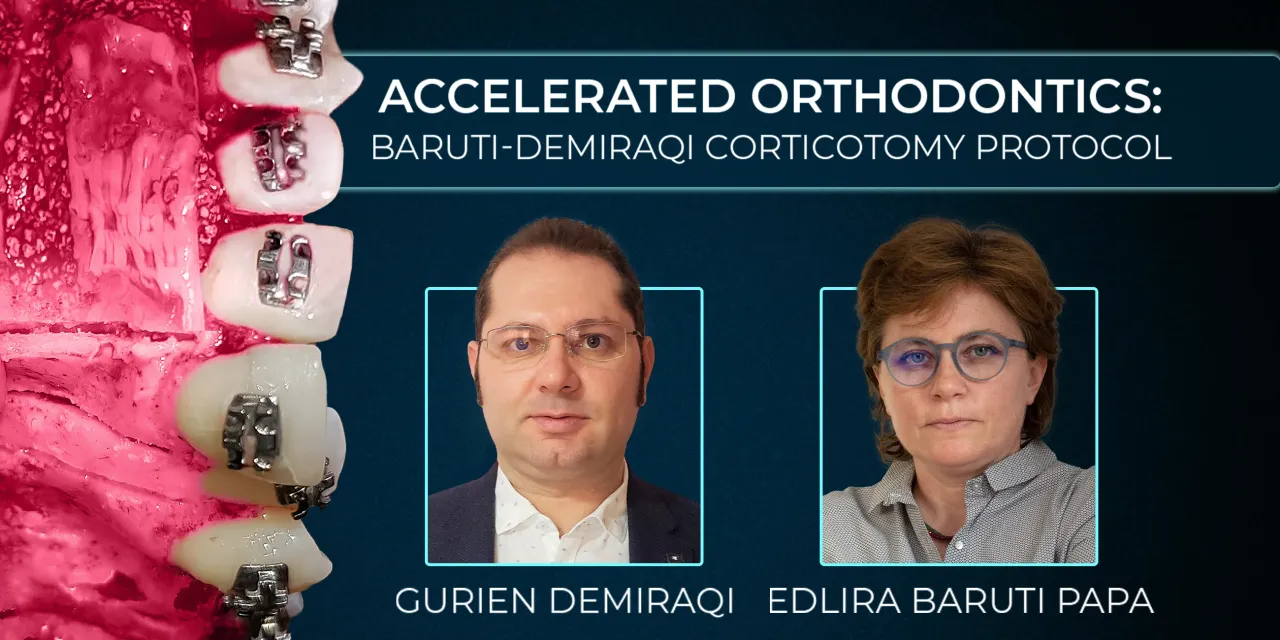 OHI-S Accelerated orthodontics Baruti-Demiraqi corticotomy protocol