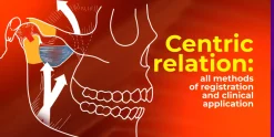 OHI-S Centric relation all methods of registration and clinical application