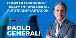 OHI-S Complex endodontiс treatment and dental autotransplantation