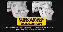 OHI-S Predictable Functional Occlusion Roth Philosophy, Masahiro Kuwata’s Protocols, and the TMJ-First Concept
