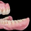 OHI-S Removable Dentures Online Course In 9 lessons 15h30m