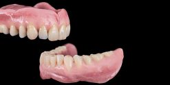 OHI-S Removable Dentures Online Course In 9 lessons 15h30m