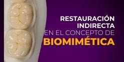 OHI-S Restauración indirecta en el concepto de biomimética Spanish