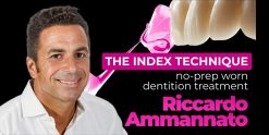 OHI-S The Index Technique. No-prep worn dentition treatment