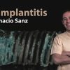 Osteocom Peri-implantitis by Ignacio Sanz