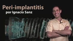 Osteocom Peri-implantitis by Ignacio Sanz