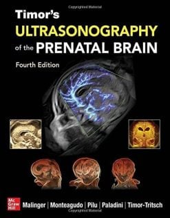 Timor’s Ultrasonography of the Prenatal Brain, 4th edition (Original PDF from Publisher)