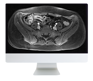 ARRS A Guide to Bowel Imaging 2019