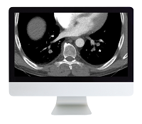 Clinical Cardiopulmonary Imaging Review 2019 (ARRS VIDEOS)