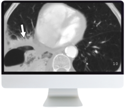 ARRS Radiology Review: Multispecialty Cases 2019