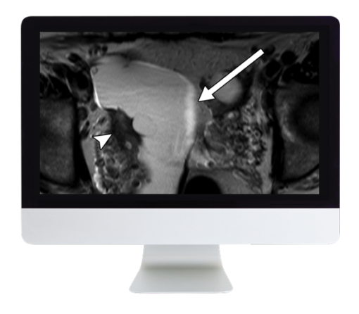 ARRS Women’s Imaging 2019