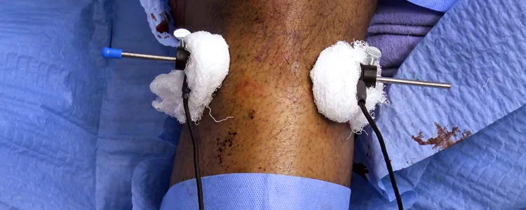 surgical Video Articles JOMI Video Journal Peer Reviewed 2023 - Image 4