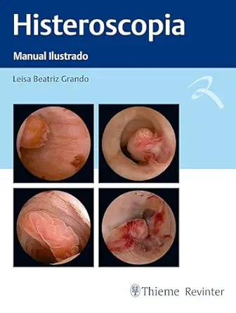 Histeroscopia: Manual Ilustrado (Portuguese Edition) (EPUB and pdf) Histeroscopia: Manual Ilustrado (Portuguese Edition) (EPUB and pdf)