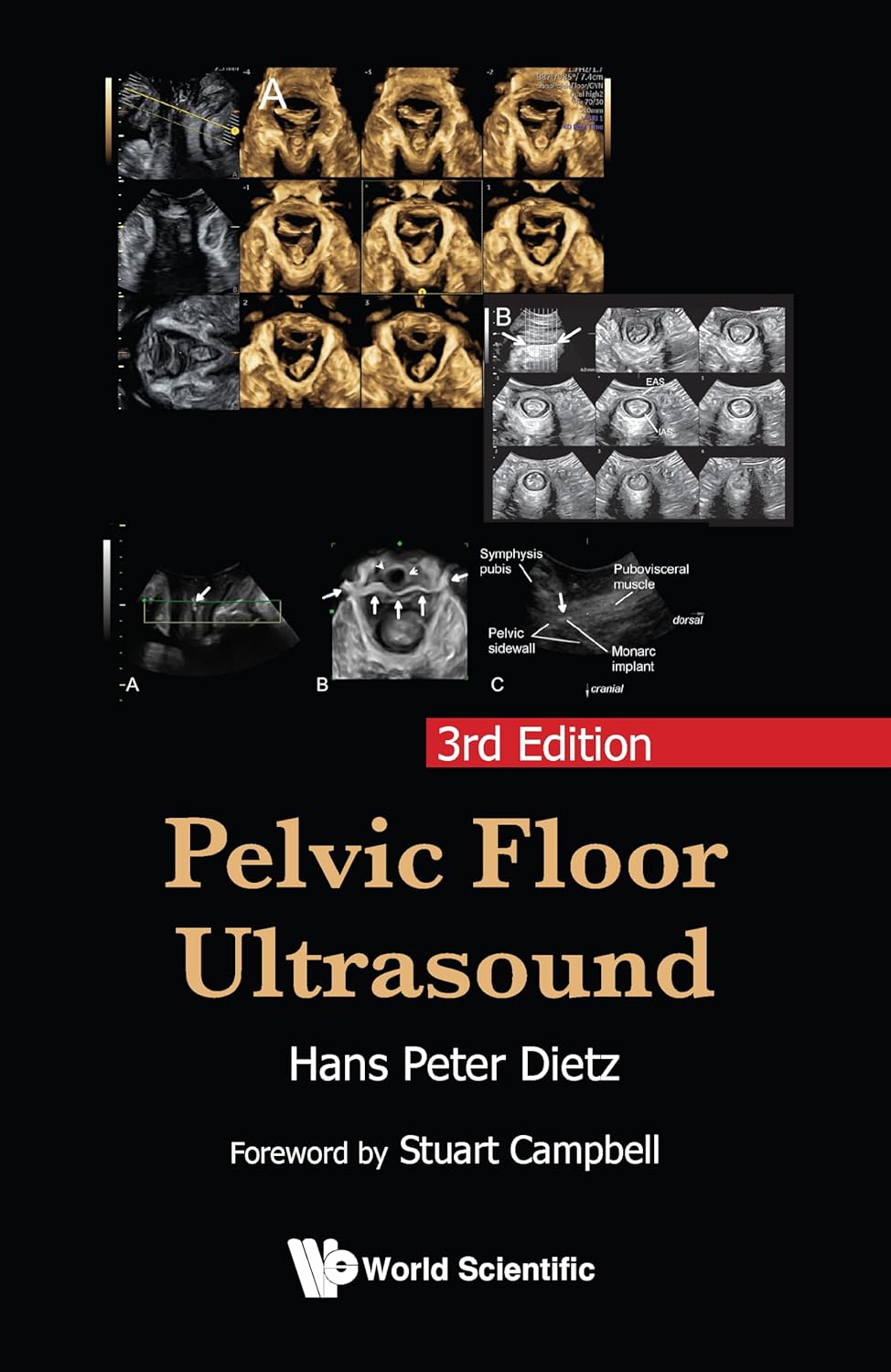 Pelvic Floor Ultrasound, 3rd Edition (EPUB and pdf) Pelvic Floor Ultrasound, 3rd Edition (EPUB and pdf)
