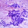 Cytopathology: Masters of Pathology Series 2026 (Videos + PDF) Cytopathology Masters of Pathology Series 2026 (Videos + PDF)