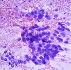 Cytopathology Masters of Pathology Series 2026 (Videos + PDF)