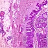 Dermatopathology: Masters of Pathology Series 2025 (Videos + PDF) Dermatopathology Masters of Pathology Series 2025 (Videos + PDF)