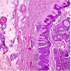 Dermatopathology Masters of Pathology Series 2025 (Videos + PDF)