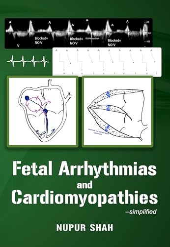 Fetal Arrhythmias and Cardiomyopathies – simplified (AZW3 + EPUB + Converted PDF) Fetal Arrhythmias and Cardiomyopathies – simplified (AZW3 + EPUB + Converted PDF)
