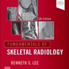 Fundamentals of Skeletal Radiology, 6th edition (True PDF) Fundamentals of Skeletal Radiology, 6th edition (True PDF)