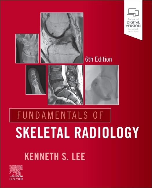 Fundamentals of Skeletal Radiology, 6th edition (True PDF) Fundamentals of Skeletal Radiology, 6th edition (True PDF)
