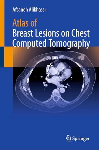 Atlas of Breast Lesions on Chest Computed Tomography (Original PDF from Publisher) Atlas of Breast Lesions on Chest Computed Tomography (Original PDF from Publisher)