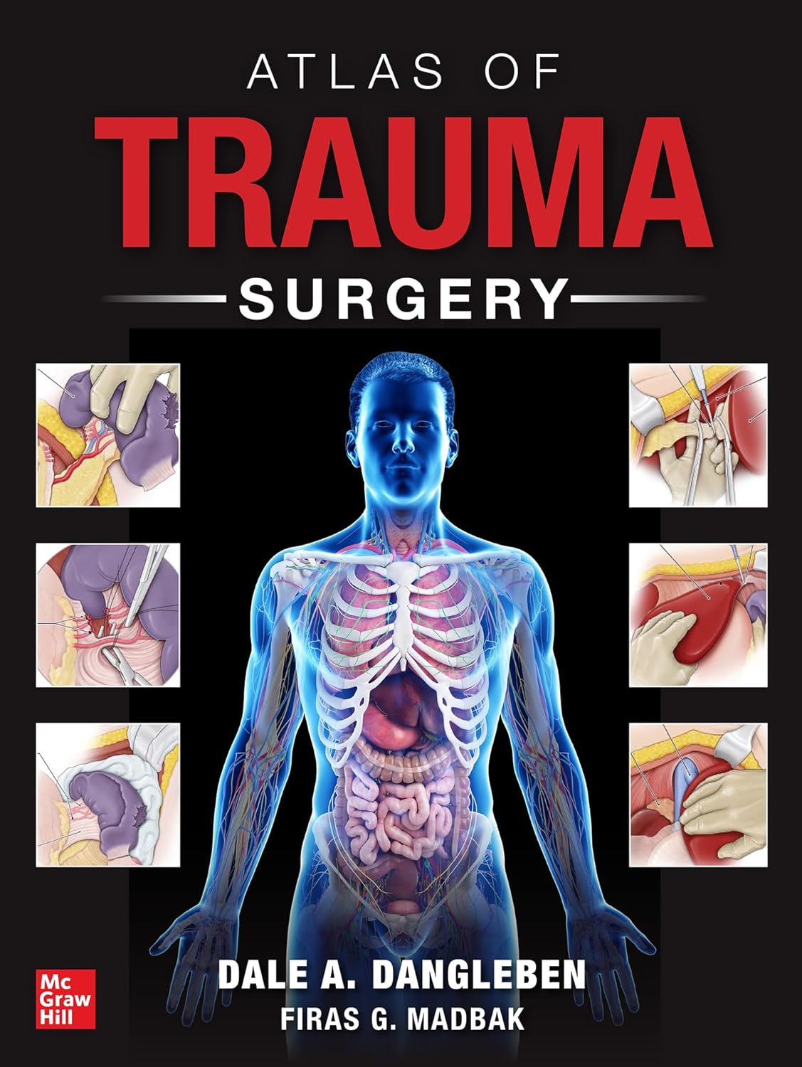 Atlas of Trauma Surgery (Original PDF from Publisher) Atlas of Trauma Surgery (Original PDF from Publisher)