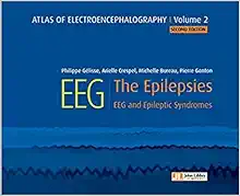 Atlas of electroencephalography