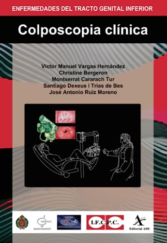 Colposcopia clinica (Spanish Edition) (Original PDF from Publisher) Colposcopia clinica (Spanish Edition) (Original PDF from Publisher)