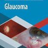 Glaucoma (Spanish Edition) (Original PDF from Publisher) Glaucoma (Spanish Edition) (Original PDF from Publisher)
