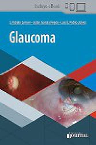 Glaucoma (Spanish Edition) (Original PDF from Publisher) Glaucoma (Spanish Edition) (Original PDF from Publisher)