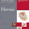 Master Techniques in Surgery: Hernia, 2nd Edition (EPUB) Master Techniques in Surgery: Hernia, 2nd Edition (EPUB)
