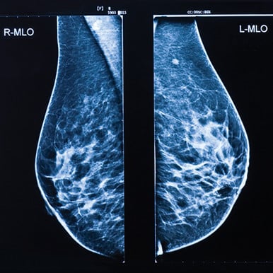 Oakstone UCSF Breast Imaging 2026 Oakstone UCSF Breast Imaging 2026