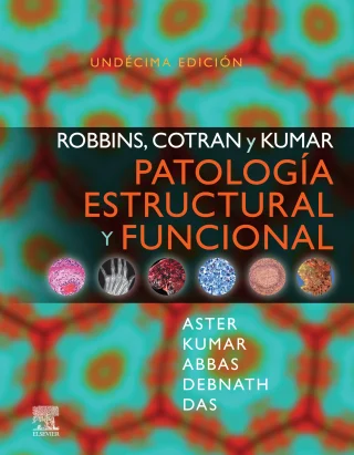 Robbins, Cotran y Kumar. Patología estructural y funcional (Spanish Edition), 11th Edition (Original PDF from Publisher) Robbins, Cotran y Kumar. Patología estructural y funcional (Spanish Edition), 11th Edition (Original PDF from Publisher)