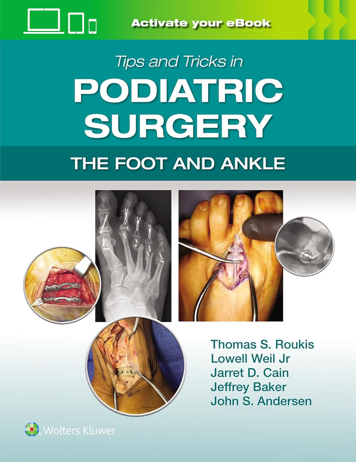 Tips and Tricks in Podiatric Surgery: The Foot and Ankle (EPUB) Tips and Tricks in Podiatric Surgery
