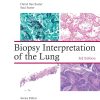 Biopsy Interpretation of the Lung (Biopsy Interpretation Series) (EPUB and pdf) Biopsy Interpretation of the Lung (Biopsy Interpretation Series) (EPUB)
