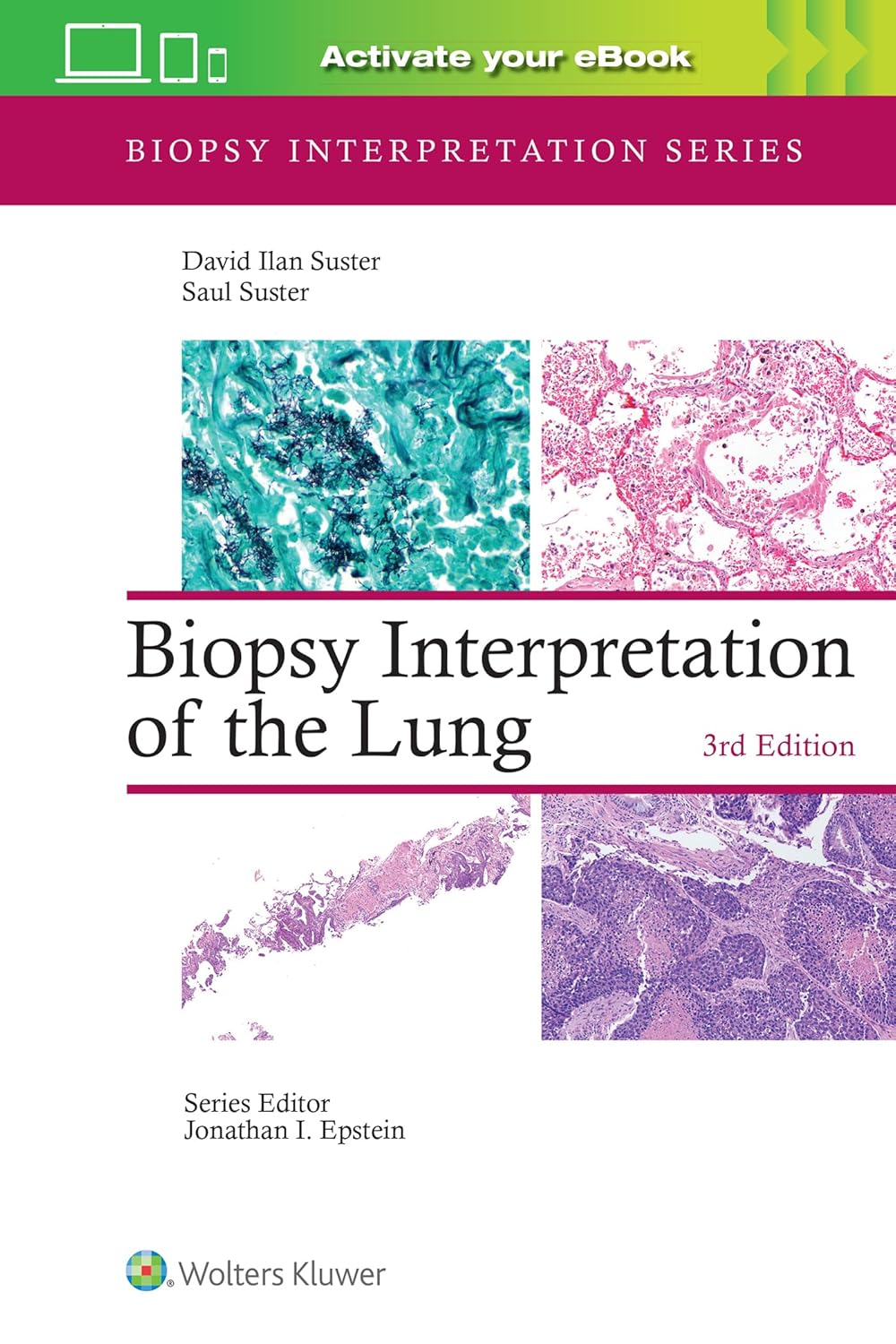 Biopsy Interpretation of the Lung (Biopsy Interpretation Series) (EPUB and pdf) Biopsy Interpretation of the Lung (Biopsy Interpretation Series) (EPUB)