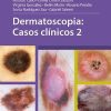 Dermatoscopia: Casos clinicos 2 (Scanned PDF) Dermatoscopia: Casos clinicos 2 (Scanned PDF)