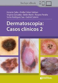 Dermatoscopia: Casos clinicos 2 (Scanned PDF)