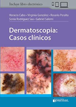 Dermatoscopia: Casos clínicos (Spanish Edition) (Scanned PDF)