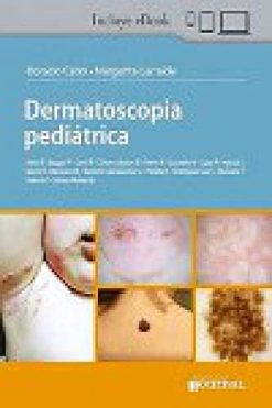 Dermatoscopia pediatrica (Scanned PDF)