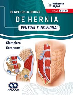 El Arte de la Cirugía de Hernia, Ventral e Incisional (Spanish Edition) (Scanned PDF)