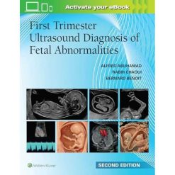 First Trimester Ultrasound Diagnosis of Fetal Abnormalities, 2nd edition (EPUB)