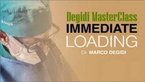 Osteocom Degidi MasterClass Immediate Loading (Old Version) Osteocom Degidi MasterClass Immediate Loading (Old Version)