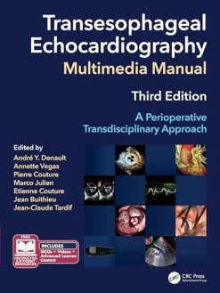 Transesophageal Echocardiography Multimedia Manual