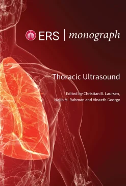 ERS Monographs: Thoracic Ultrasound (EPUB)